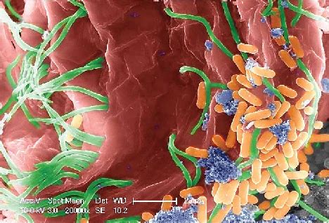  Trombidium! Bir Mikrokozmun İçi: Trombidium Ciliatının Gizemli Dünyası